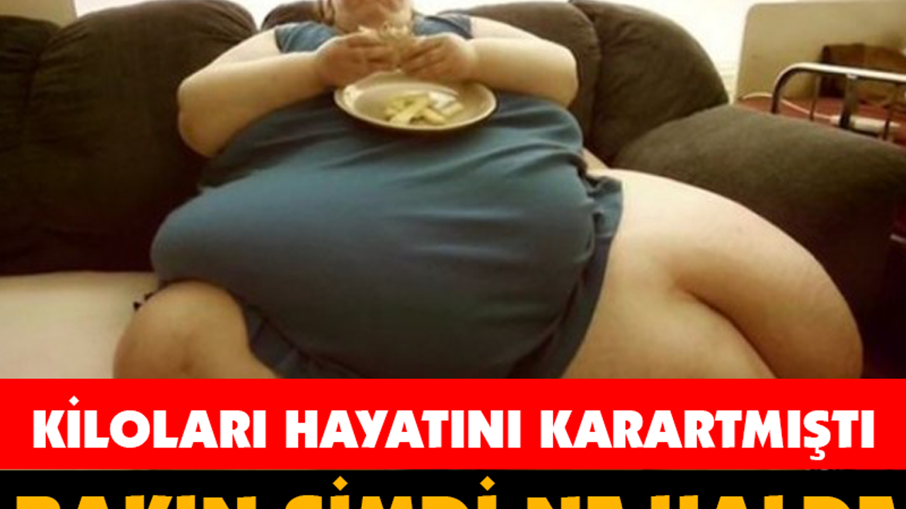 BAKIN ŞİMDİ NE HALDE... KİLOLARI HAYATINI KARARTMIŞTI!