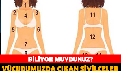 VÜCUDUMUZDA ÇIKAN SİVİLCELER BİZE NEYİ ANLATIYOR? BİLİYORMUYDUNUZ?