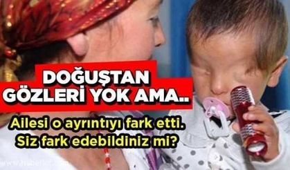 Gözleri Doğuştan Yok Ama.. Ailesi O Ayrıntıyı Fark Etti, Doktor Şok Oldu