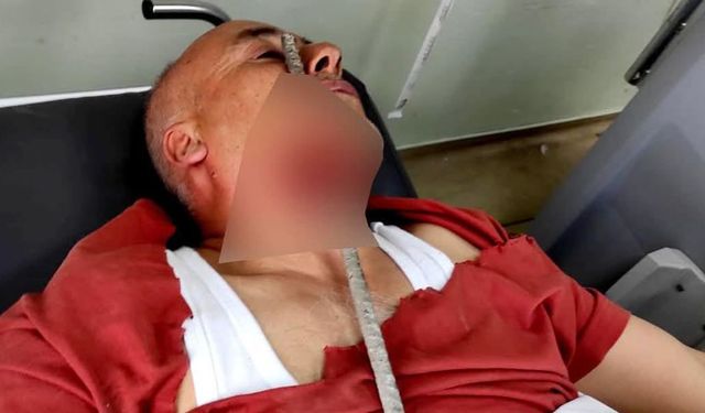 Yüzüne demir saplanan işçi ölümden döndü