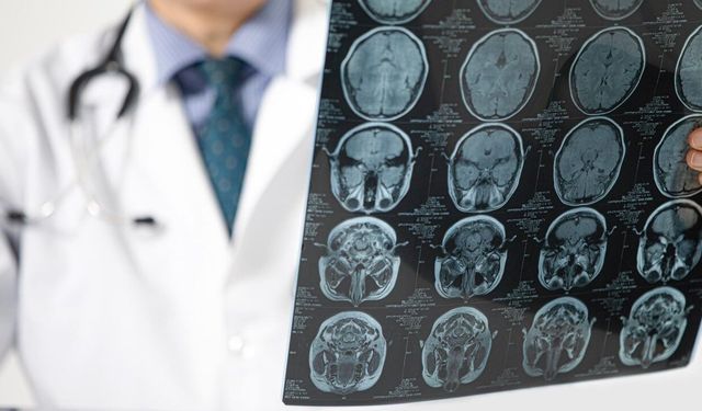 Pandemi beyni yaşlandırdı: Covid olmasanız bile etkilenmiş olabilirsiniz
