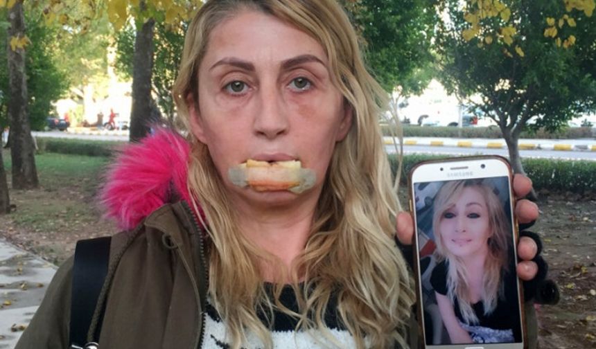 Antalya&#039;da aşçılık yapan 3 çocuk annesi Songül Uzunoğlu, gözaltı torbalarından kurtulmak için arkadaşlarının tavsiyesi üzerine geçen Şubat ayında Muratpaşa ilçesi Lara turizm bölgesindeki güzellik ve estetik merkezine gitti. Uzunoğlu&#039;na, göbek bölgesinden alınan yağın, yüz bölgesinin dolgusunda kullanılacağı, operasyonun çok kalıcı, ekonomik ve 2 yıl garantili olduğu söylendi. Estetik merkezindeki yetkililerle görüşen ve Mart ayı başında ameliyatının yapılmasını isteyen Uzunoğlu, operasyon için 5 bin 500 lirayı nakit ödedi.