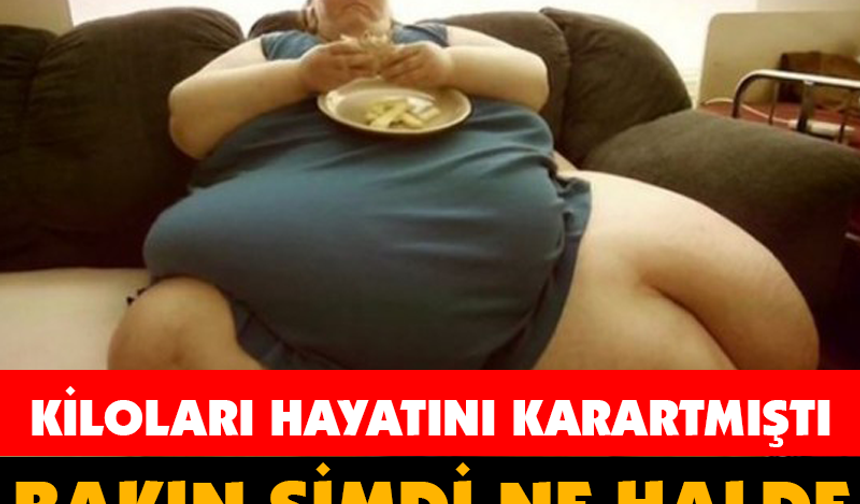 BAKIN ŞİMDİ NE HALDE... KİLOLARI HAYATINI KARARTMIŞTI!