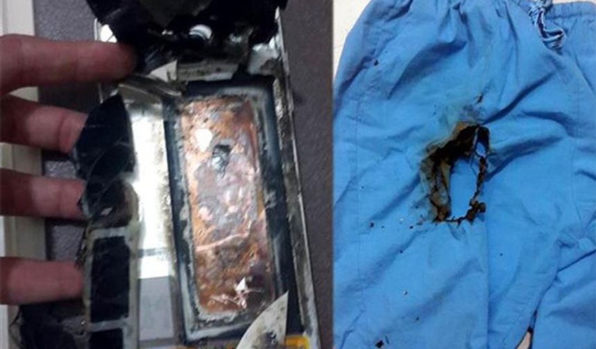 Dr. Cem Başpınar, hastanedeki odasında çalıştığı sırada pantolon cebindeki akıllı cep telefonu bir anda patlayıp alev aldı. Hemen pantolonunu çıkaran Dr. Başpınar, hastanenin acil servisine giderek yanık oluşan sağ bacağını tedavi ettirdi. Dr. Cem Başpınar’ın başvurusu üzerine hastane polisi rapor tuttu. Olay anında büyük bir panik yaşadığını ifade eden Dr. Başpınar, şöyle konuştu:
