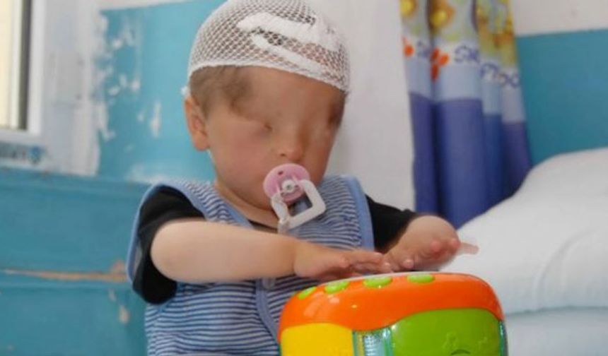 Madamihan ve Salamu çiftinin, doğuştan görme engelli çocuğunu muayene eden doktorlar, çocuğun, üzeri deri kaplı olan sol gözünün ışığa duyarlı olduğunu tespit etti..Burada çocuğu muayene eden doktorlar, çocuğun üzeri deri kaplı olan sol gözünün ışığa duyarlı olduğunu tespit etti.