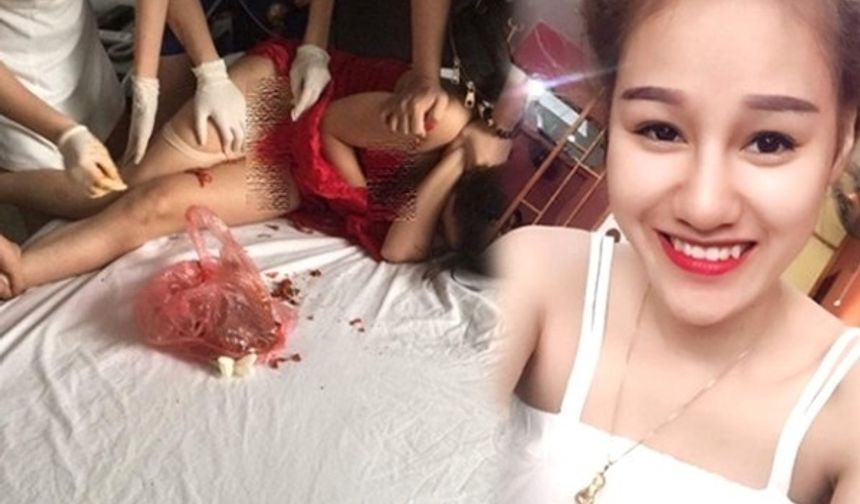 Vietnam&#039;da aldatılan kadın, kocasının birlikte olduğu kadının cinsel organına acı biber sürerek intikam aldı. Olay anının fotoğrafları sosyal medyada yayınlandı.