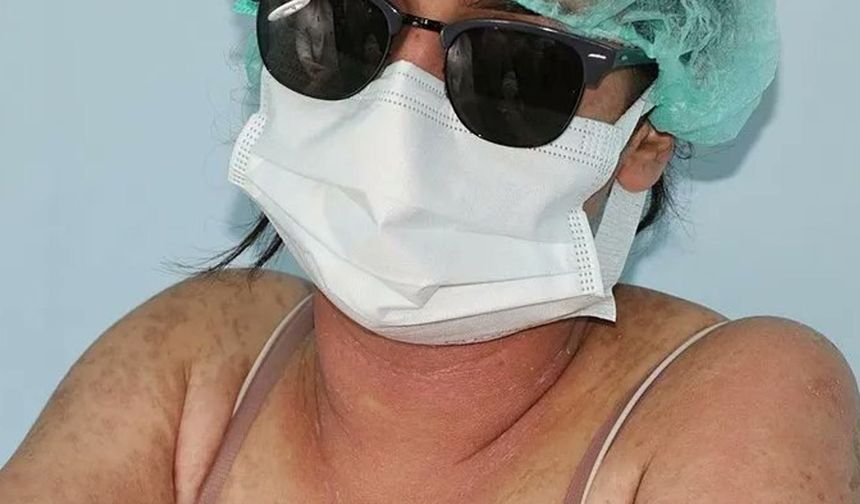 Van’da “Cilt Beyazlatıcı” kremi kullanan genç kız yoğun bakımda hayatta kaldı